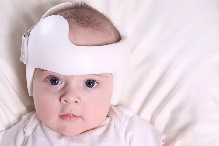 Can headband help to shape baby's head